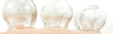 Cupping